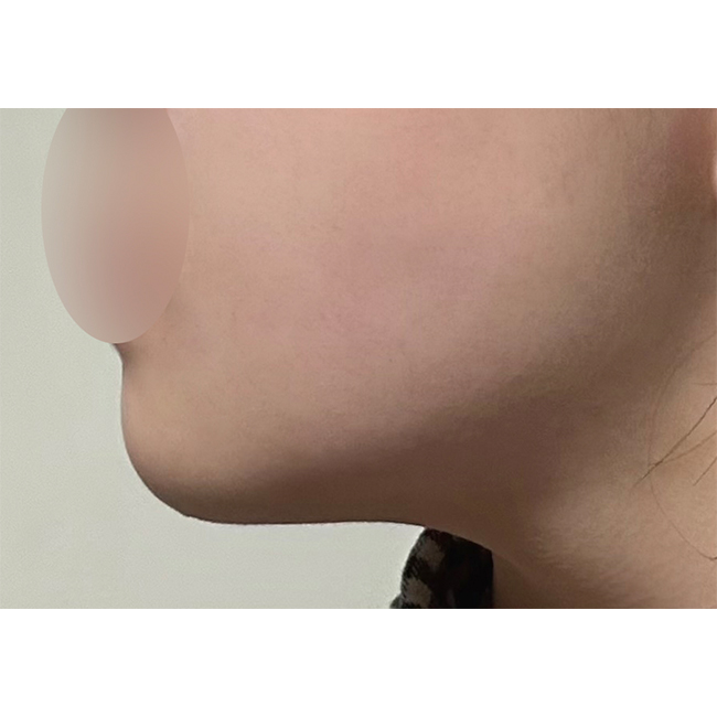 바이브 얼지흡 강!추! 합니다!