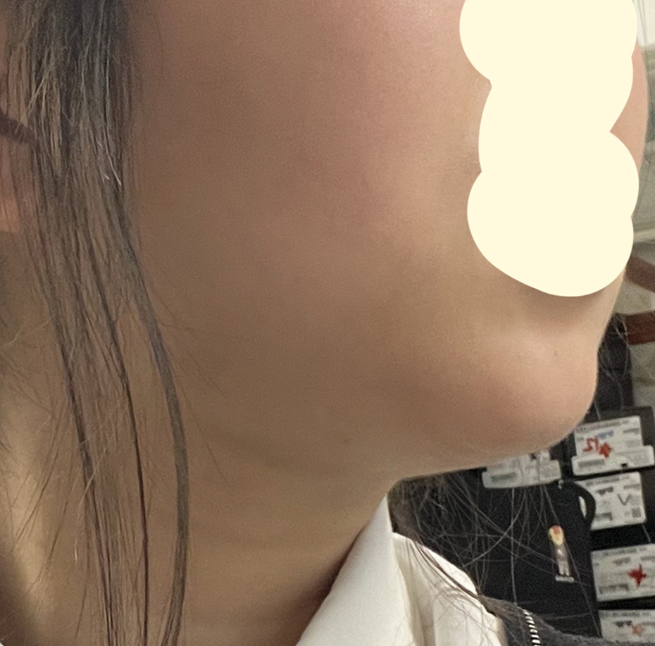 얼지흡 매우 만족중~~