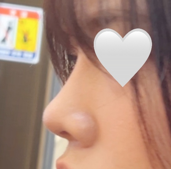 코모양 넘 예뻐서 행복 ㅎㅎ