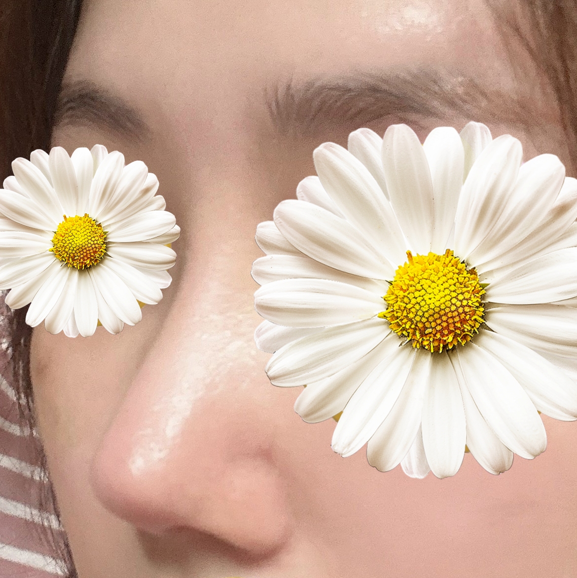 코재수술 만족 후기