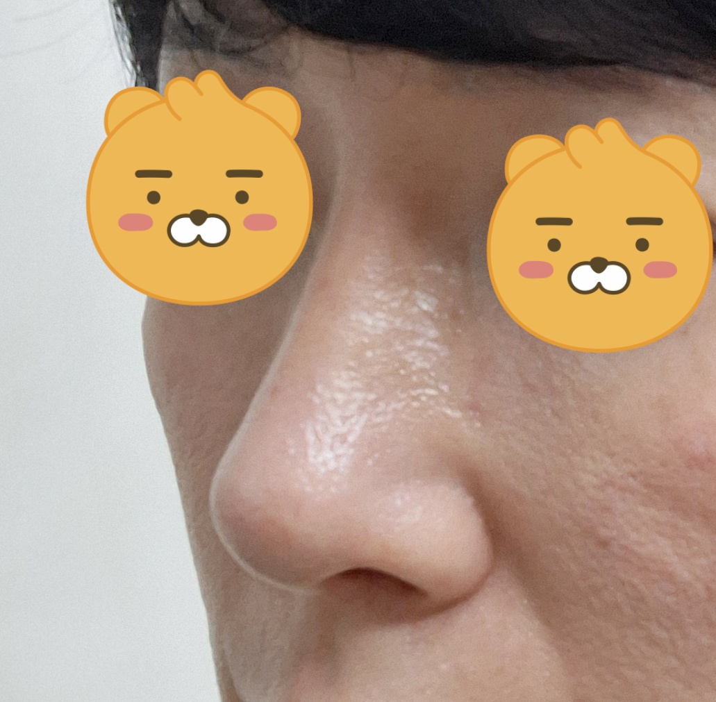 더 빨리 할걸 그랬네요 잘했다생각해요