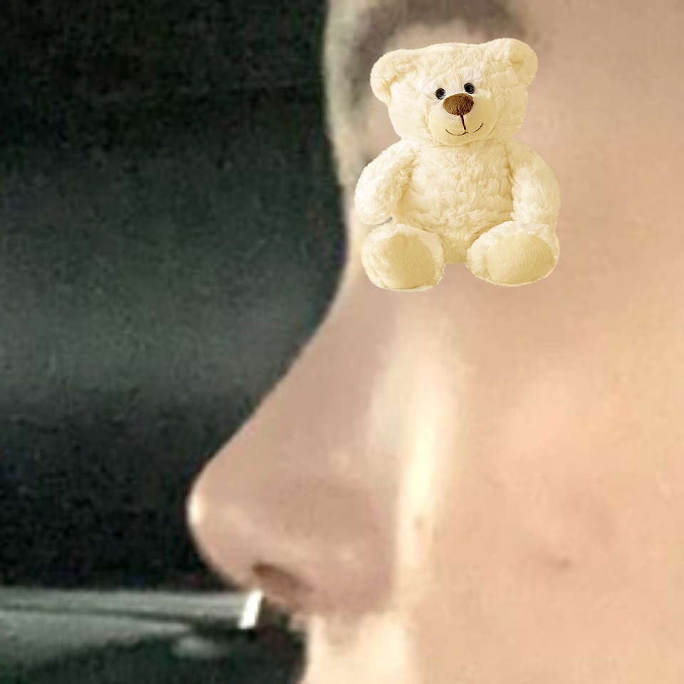 만족하는 수술입니다 !