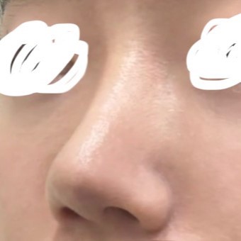 거울 볼 때 마다 너무 기분이 좋아용 ㅎㅎ