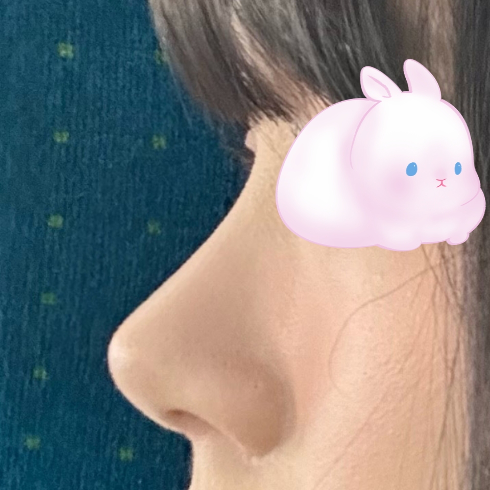 저는 첫수술부터 대성공입니다