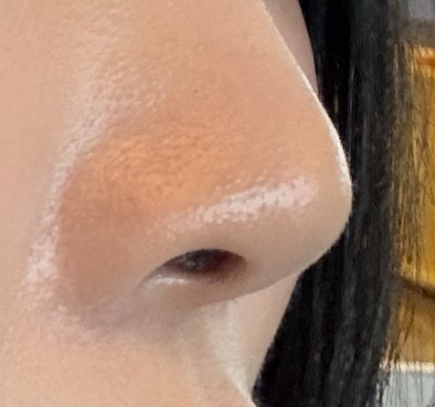 용코교정 3개월지났습니다~