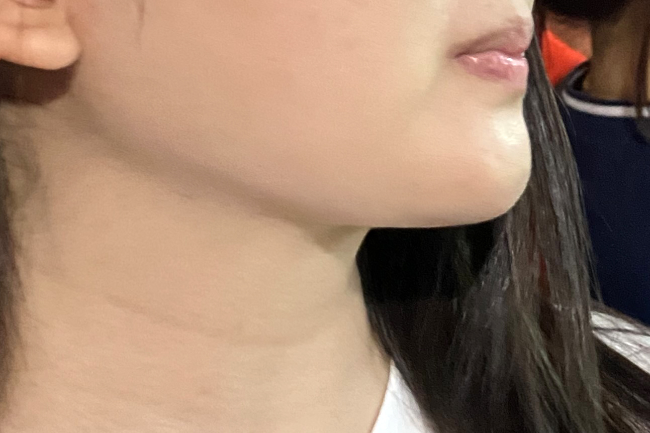 턱선라인 만들어주셔서 감사합니다