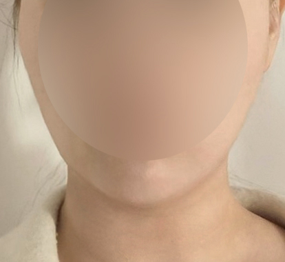 얼지흡하고 턱라인이 또렷해보여욥