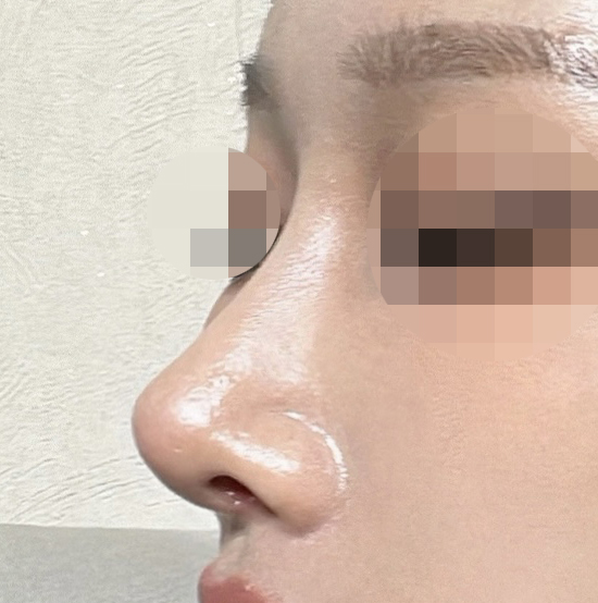 유영문원장님 실력 최고최고>.<