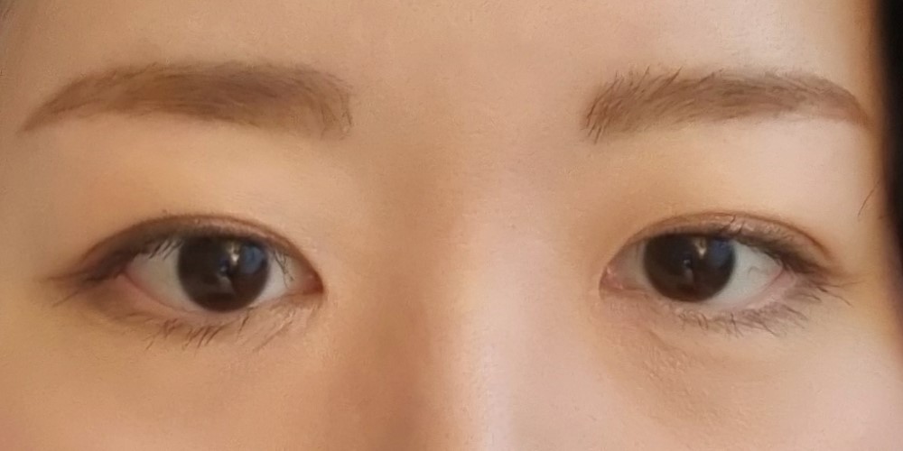 자연스러운 눈매 만들어주셨어용