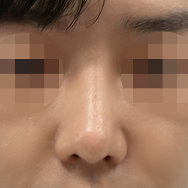 코하고 자존감도 높아졌어요!