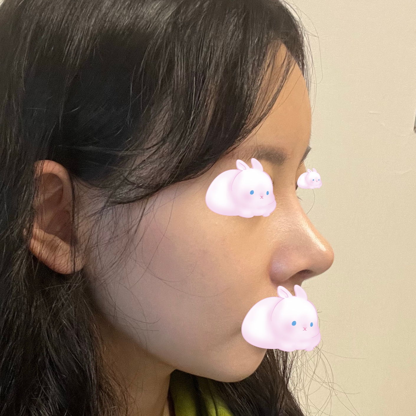 코랑 얼굴라인까지 대만족입니다!