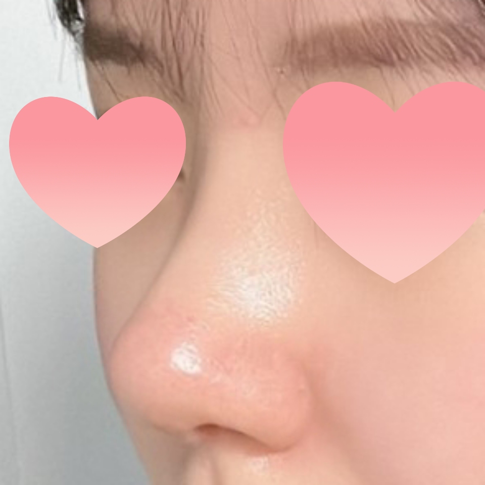 이쁜 코 만들어주셔서 감사합니다 ㅎㅎ