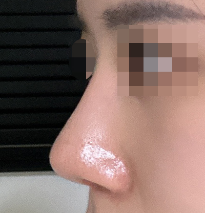 너무너무X100 코 만족!!