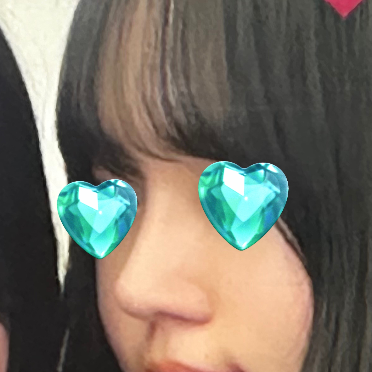 코수술 대만족 입니다!