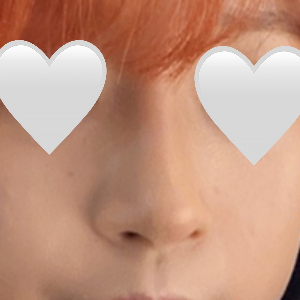 코수술 후기 원장님 감사합니다!