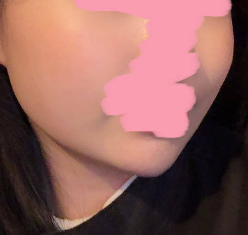 100000프로 만조꾸>_<