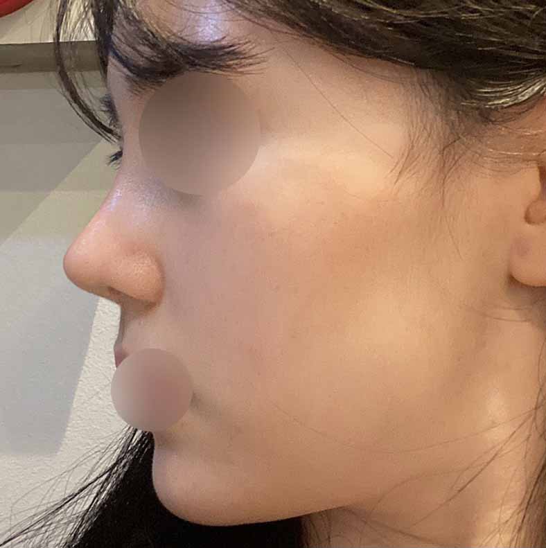 코 2주차에요ㅎㅎ