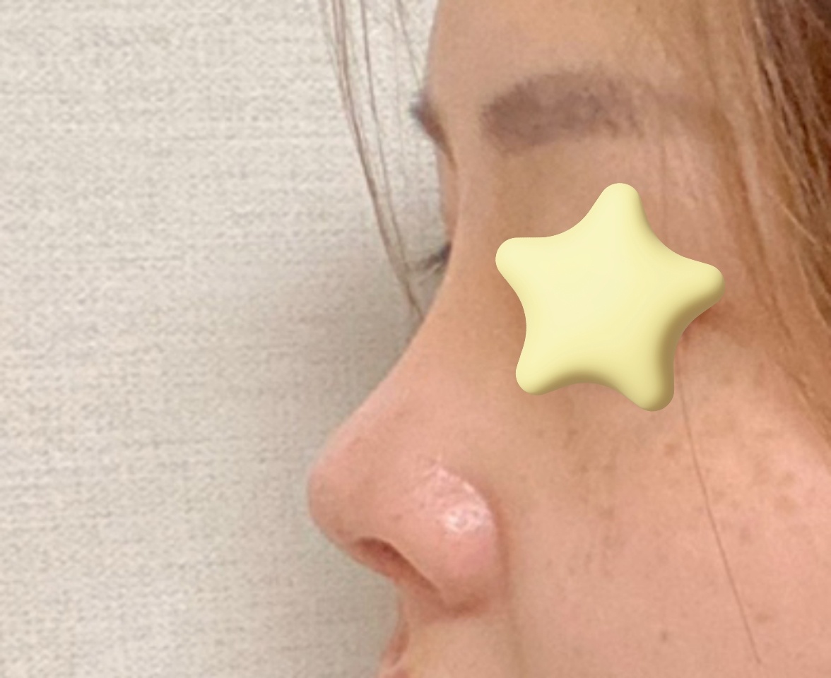 왜 눈코잘하기로 유명한지 알게써요