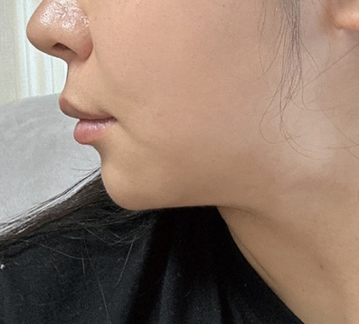 얼지흡하고나서 살빠졌단소리 많이 듣네요!!