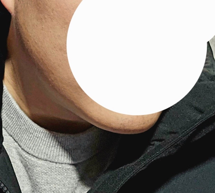 이중턱고민, 바이브에서 해결했네요