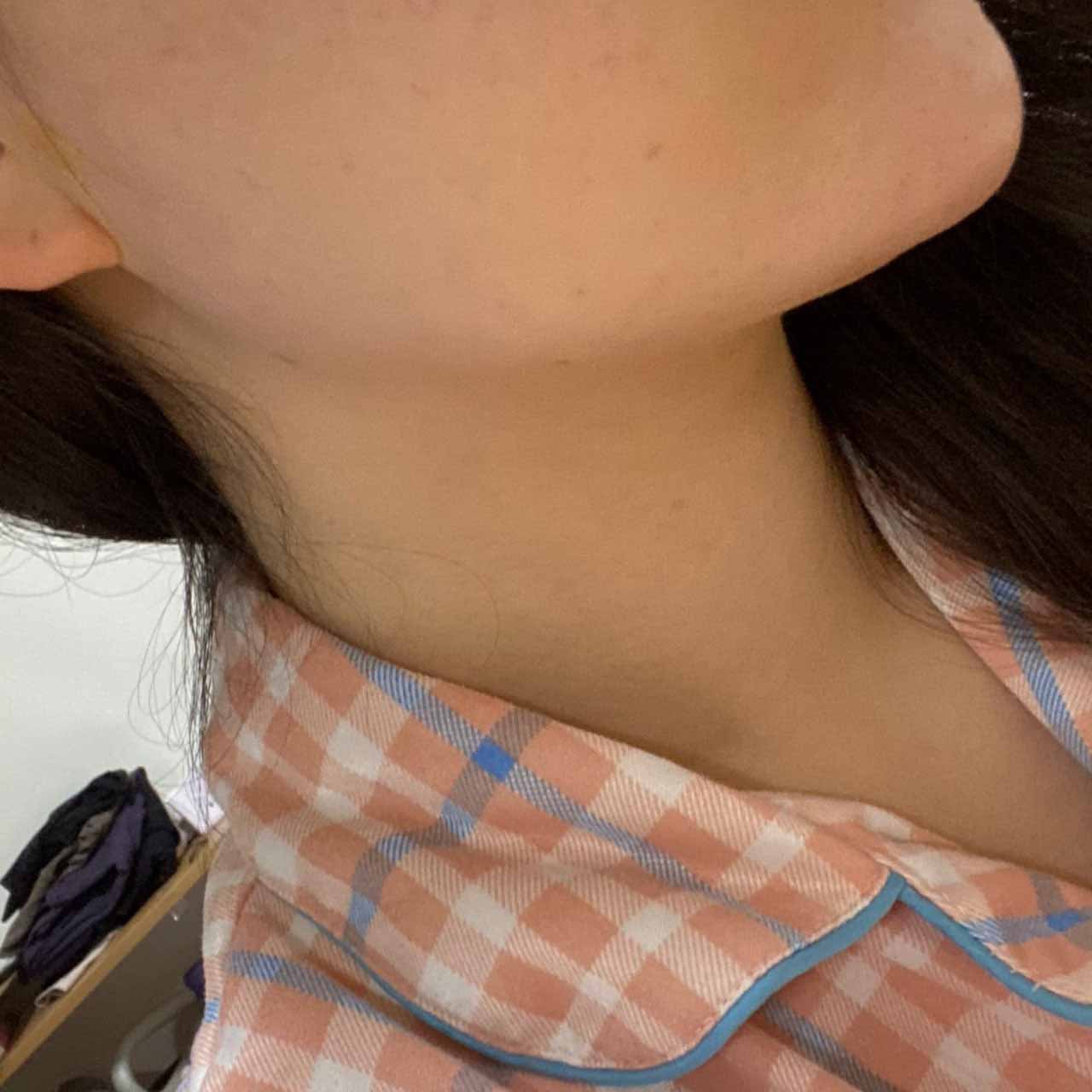 전후 차이 미쳤어요ㅋㅋㅋ