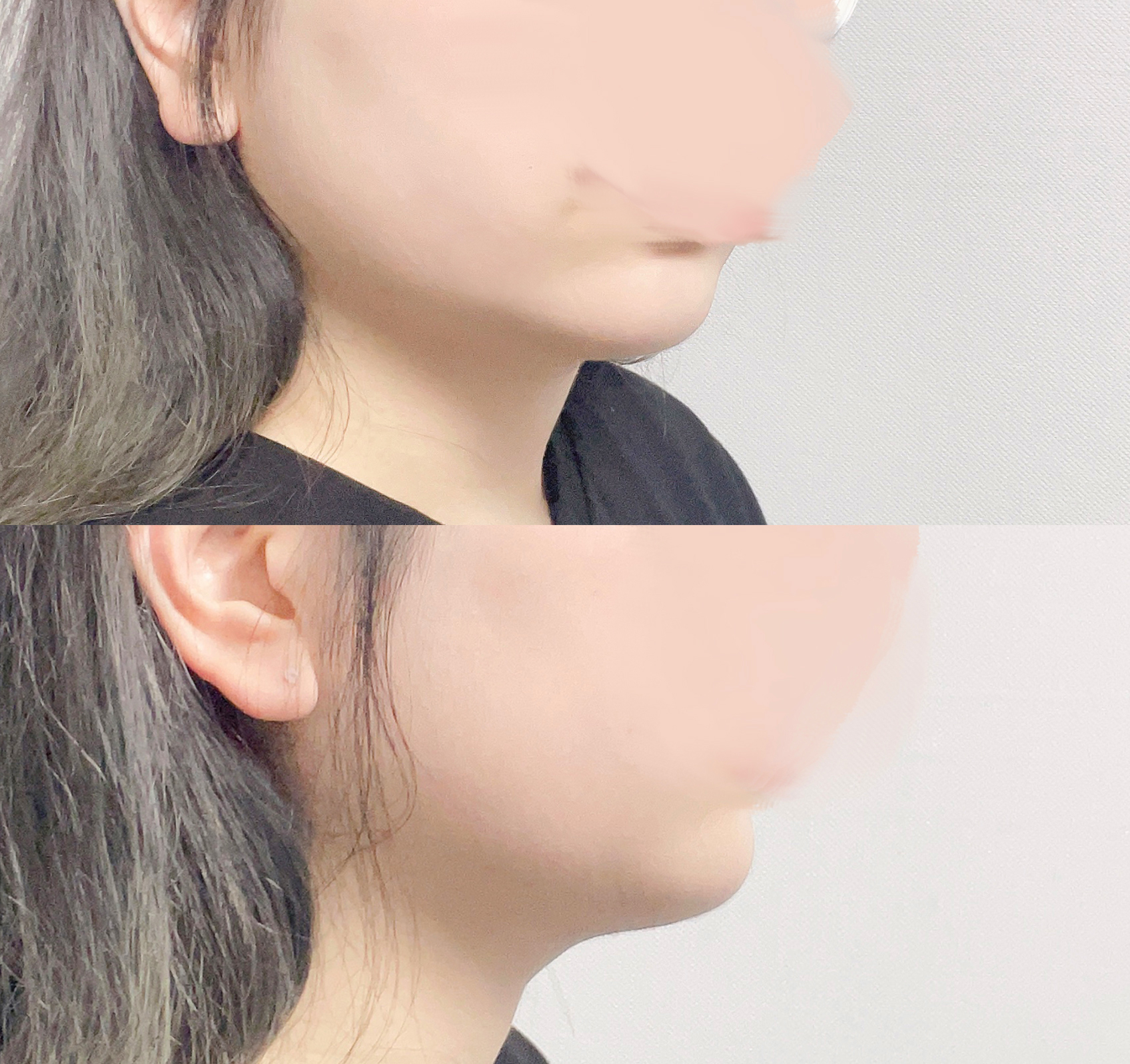 얼지흡 3개월차 후기