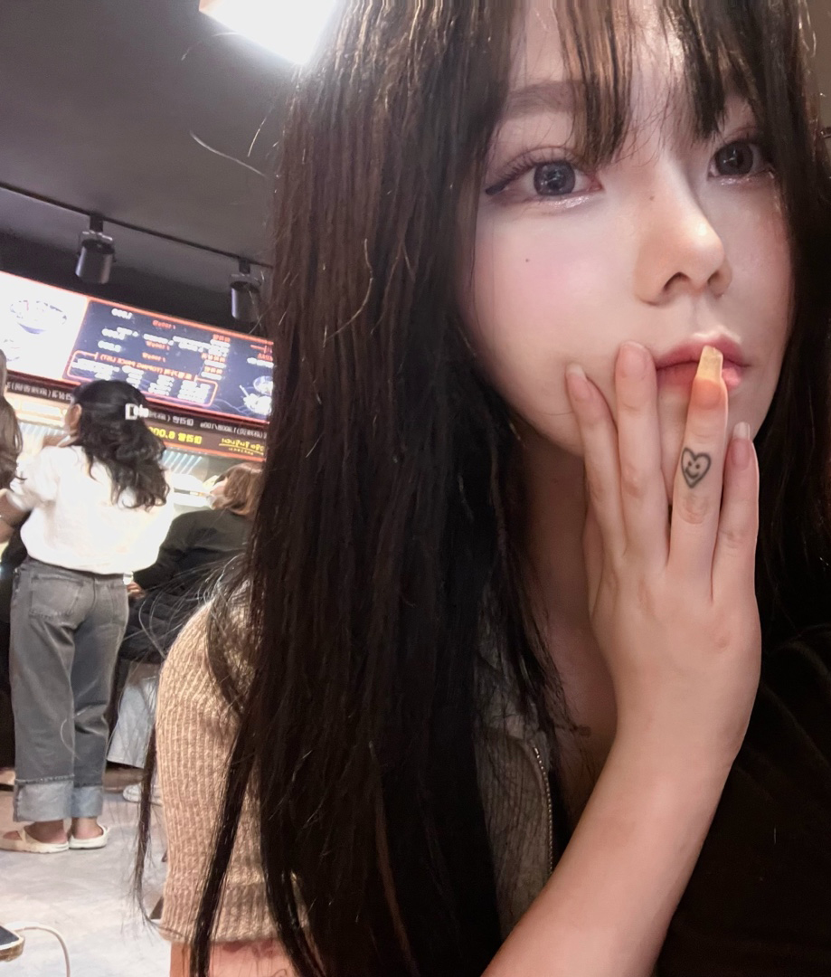 바이브에서 코수술 드디어 3달차!