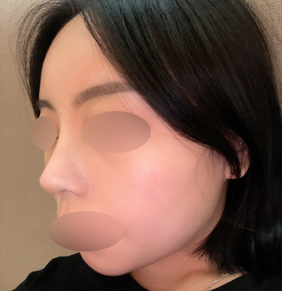 저만 알고 싶은 코성형맛집!