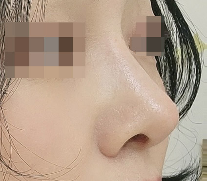 이쁜 코 만들어주셔서 감사드려요^^