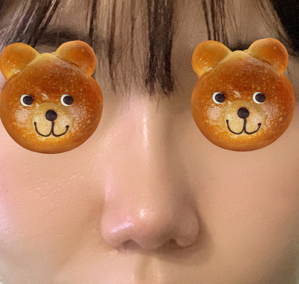 유원장님께 3개월전 코수술받았었어요~!