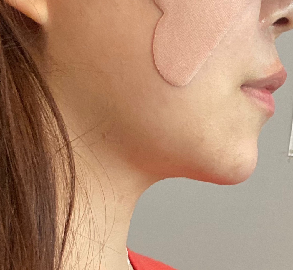 소문듣고 바이브에서 얼지흡 받았어요