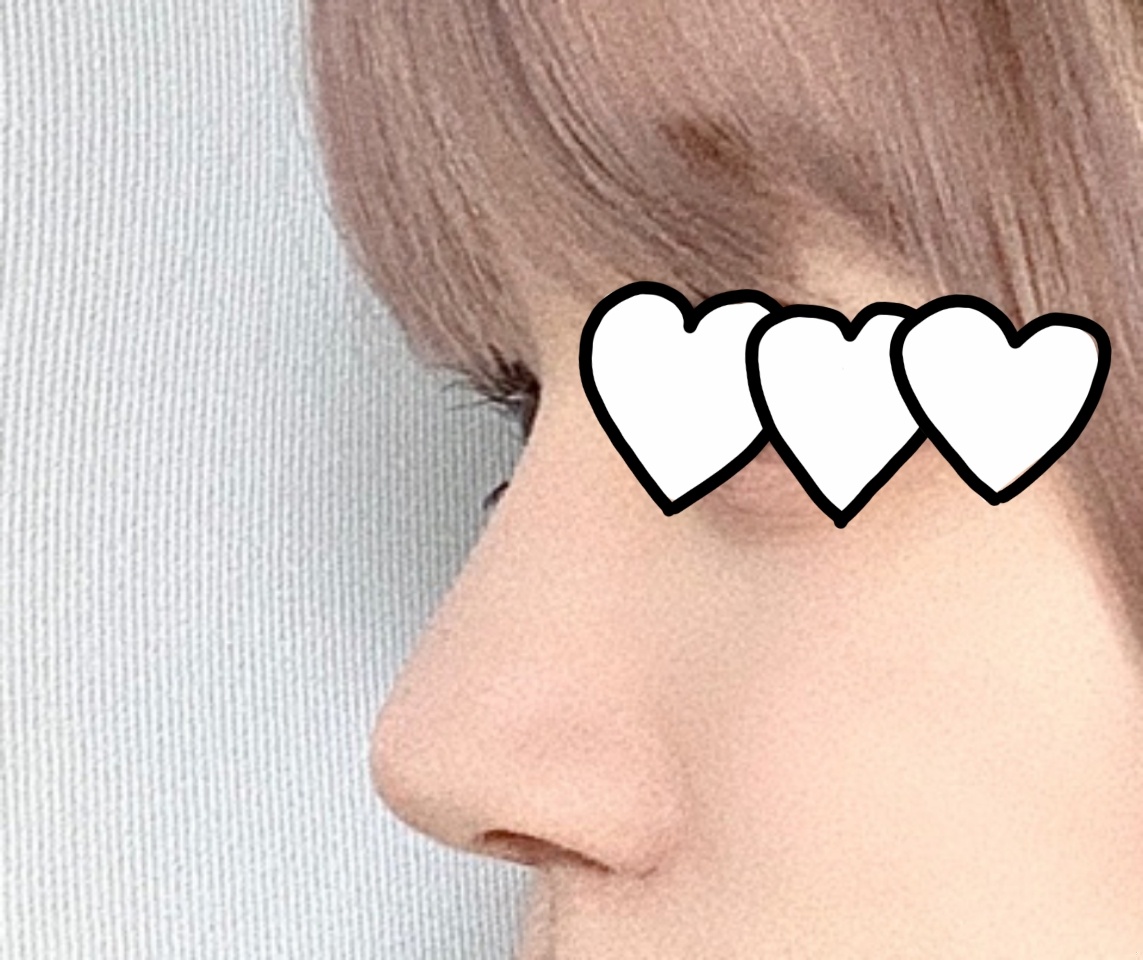 눈코는 바이브에서 하세용 ㅎㅎ강추!