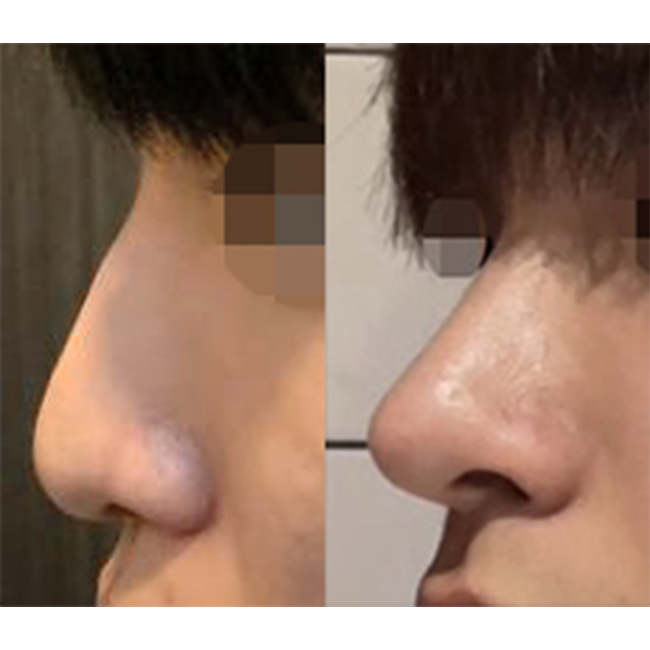 기능적인 부분, 미용적인 부분 모두 만족해요