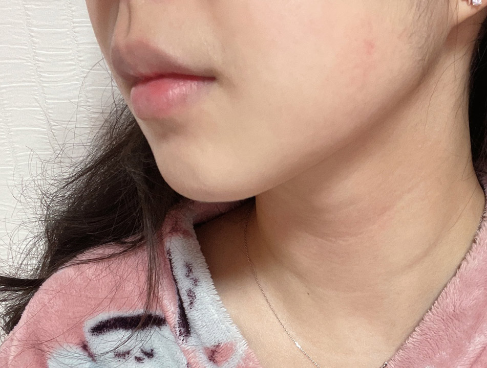 얼굴작아졌단 소리 많이 들어요