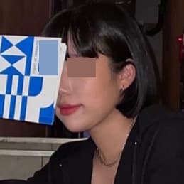 얼굴지방흡입하고 브이라인 됐어요!!!!!