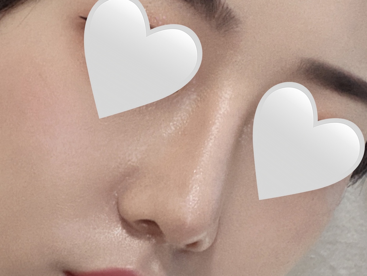 코성형 이쁘게 잘됐어요!