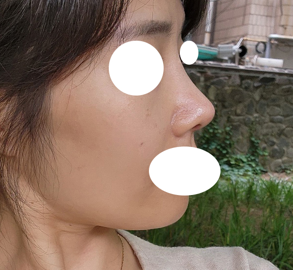 라인 너무 만족스럽네요~~~ㅎㅎ