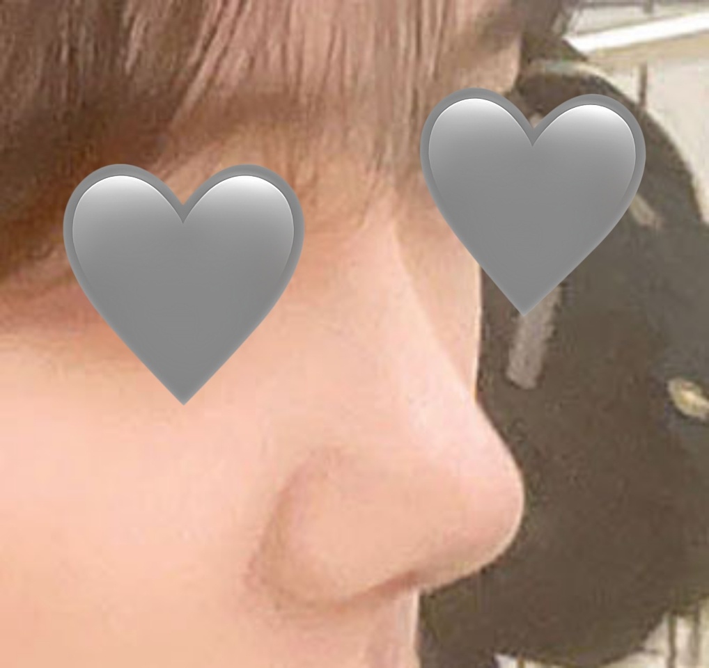 눈, 코 하고 진짜 거울 매일봄ㅎㅎ