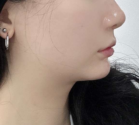 투턱살 바이브에서 진작 뺄걸 그랬어요~