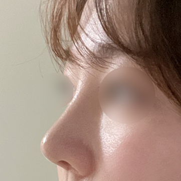 코 2주차 직반라인 !!!