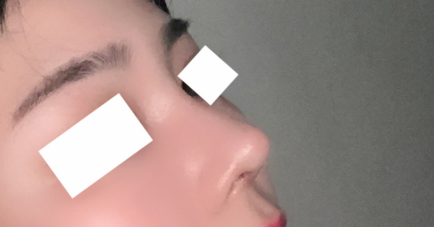 제 코 너무 예쁘죠ㅠㅠ