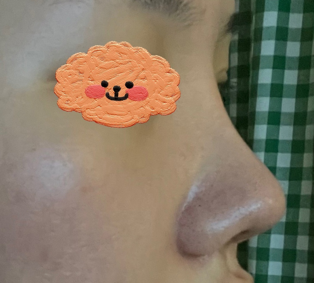 원장님이 저에게 예쁜 눈, 코 만들어주셨습니닷