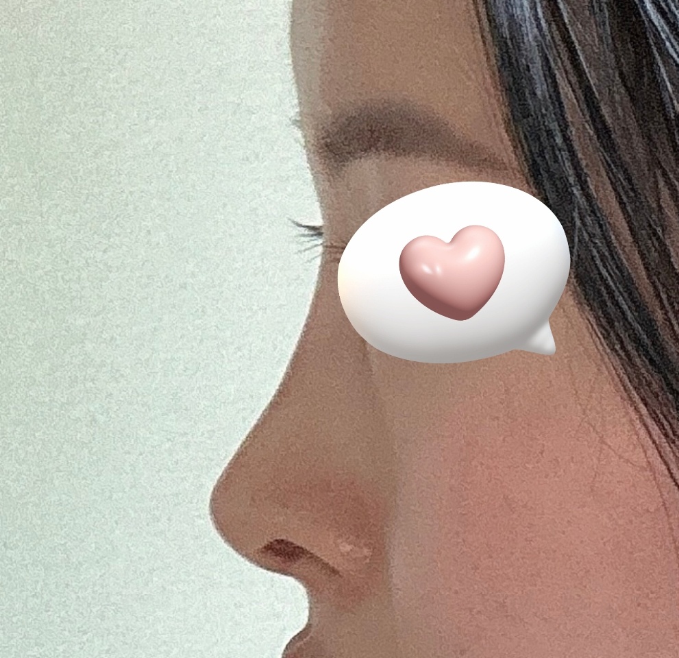 유영문원장님께 눈, 코 받았습니다!! ㅎㅎ