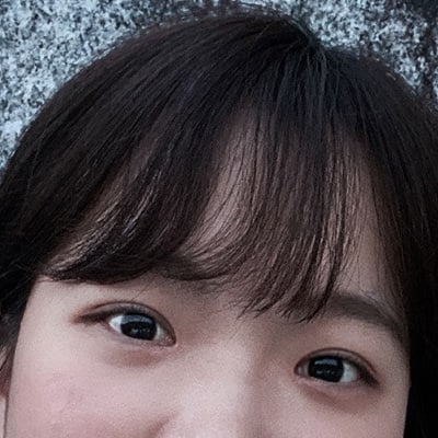 쌍꺼풀 수술 5개월차