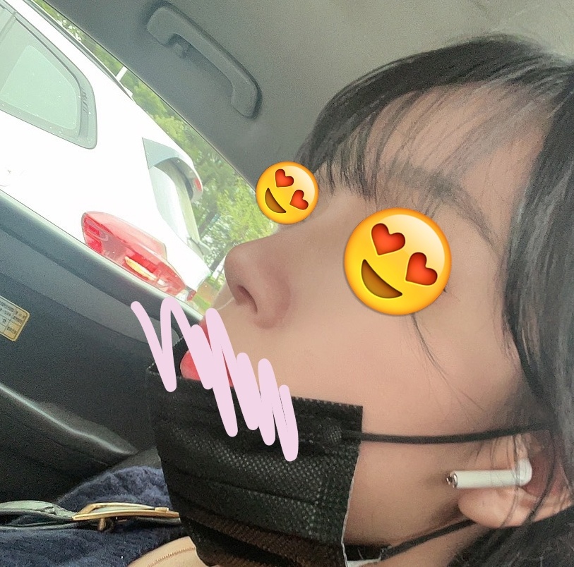 원장님이 원하던 코로 이쁘게 해주셨습니당:)