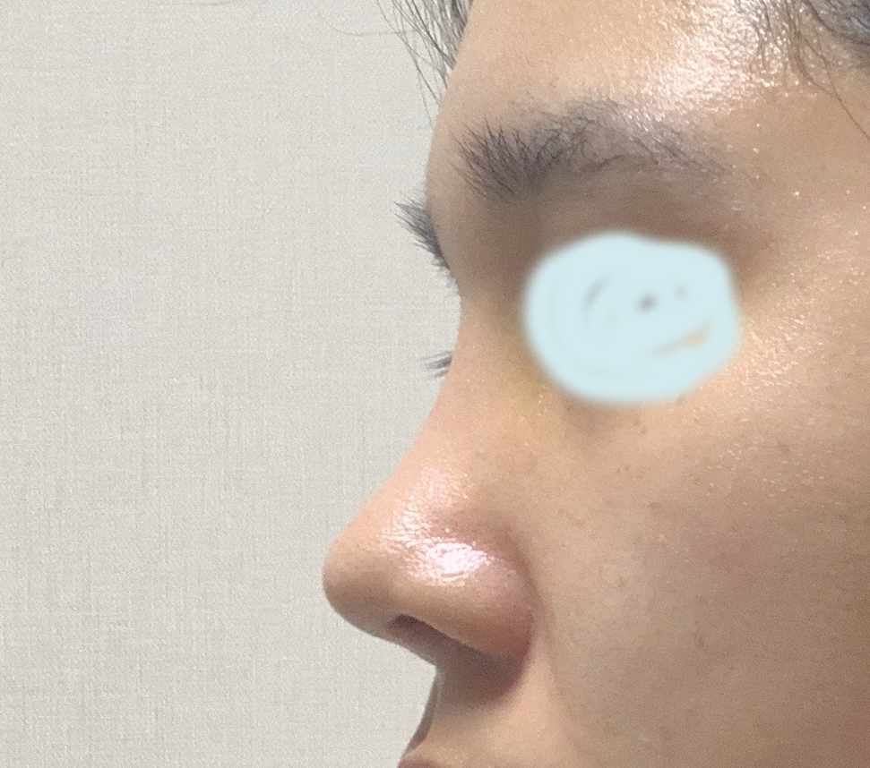 자연스럽게 높여주셨어요 ㅎㅎ