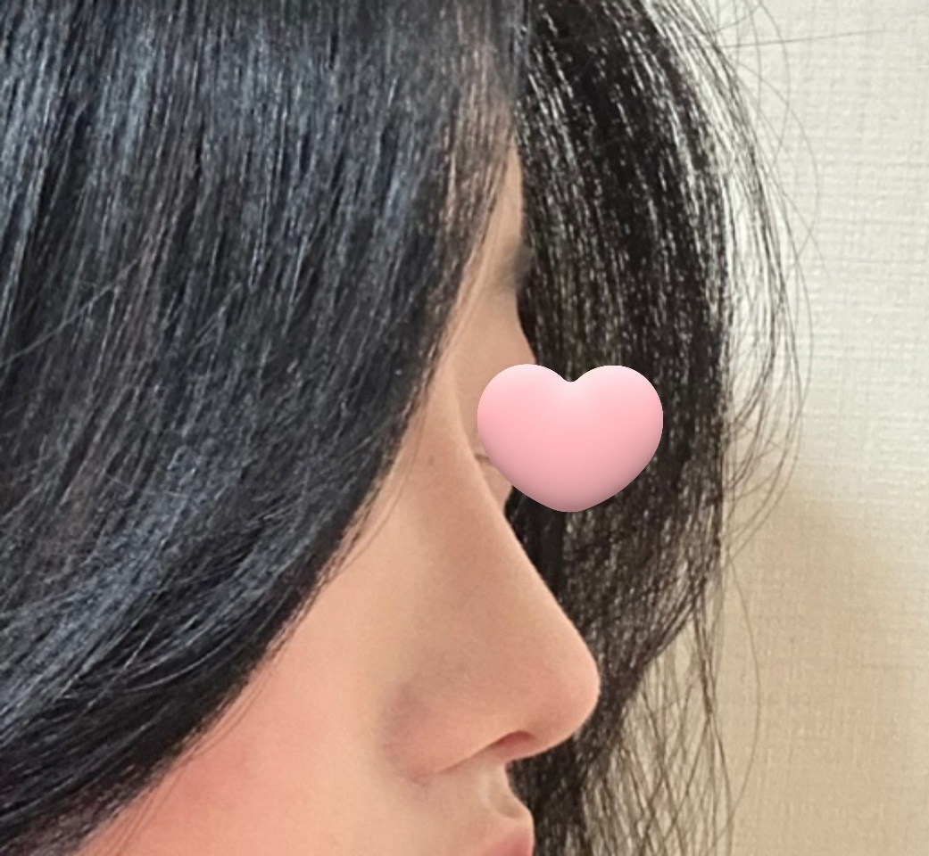 코 너무 만족해요 ㅠㅠ