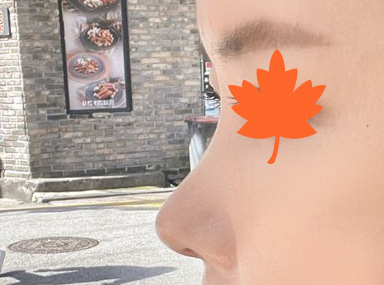 눈재수술,코성형,풀페이스지방이식