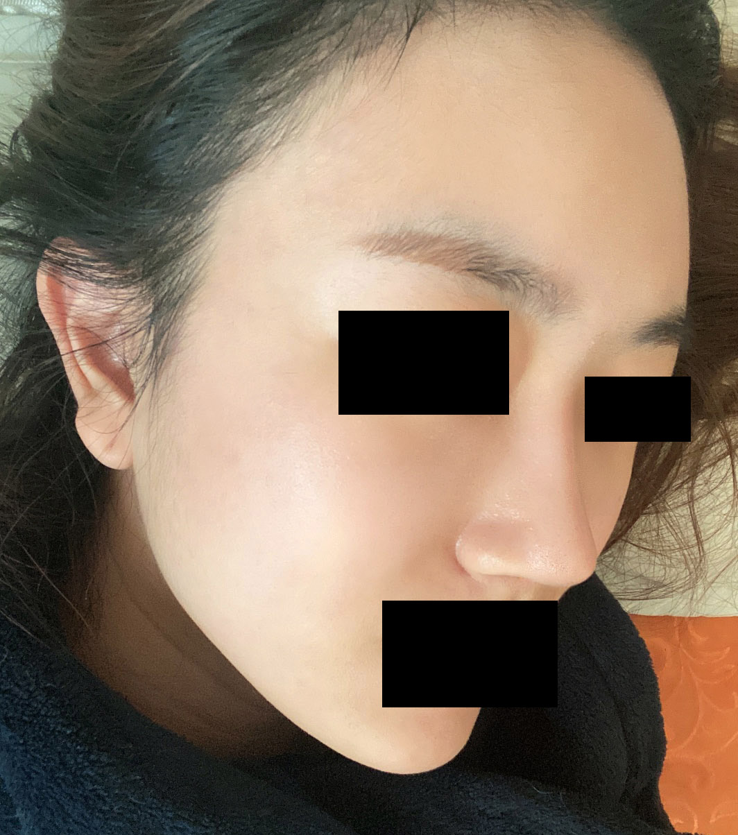 코,지이하고 주변에서 많이 물어봐요ㅎㅎ