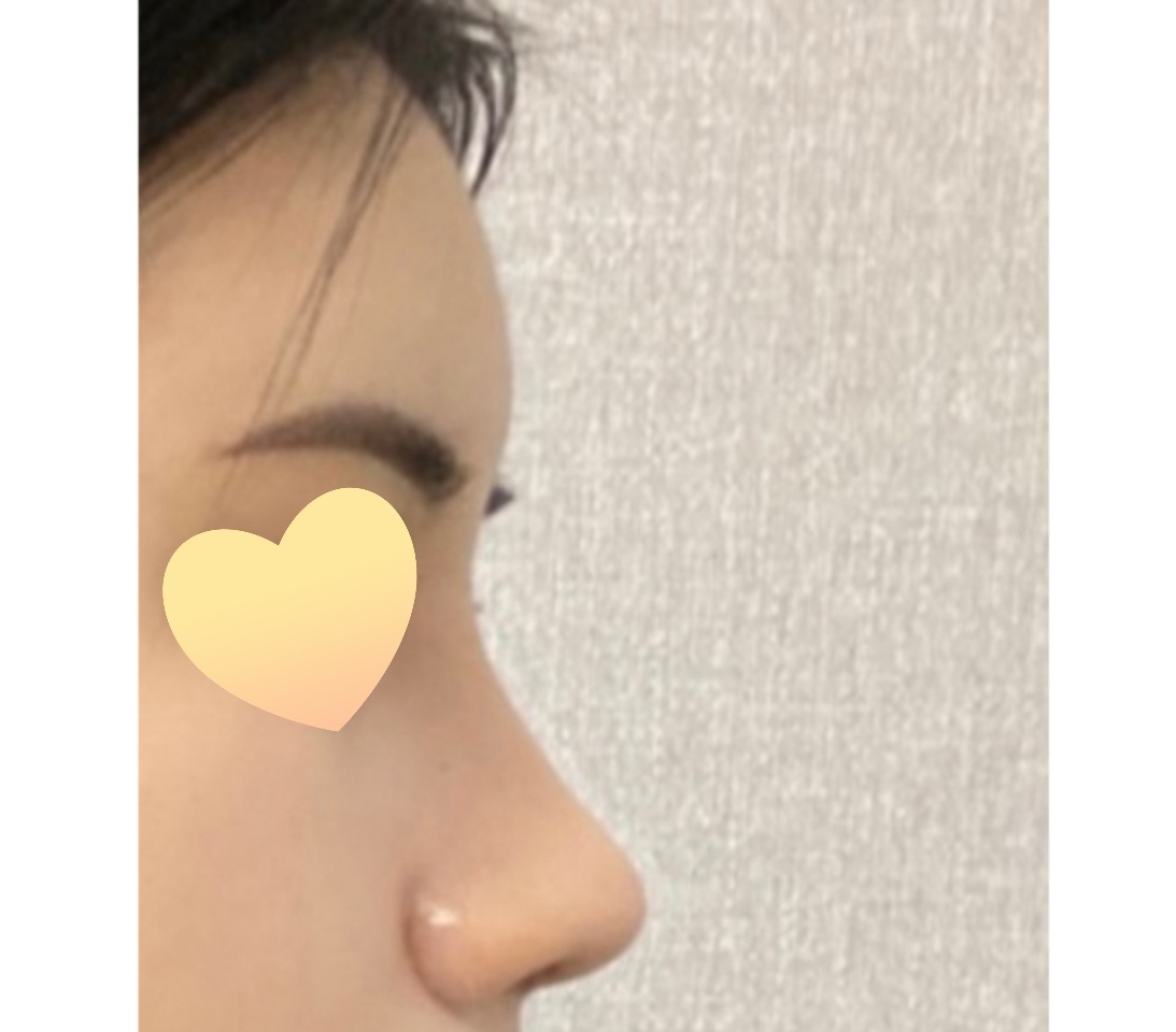 이마~코라인 너무 맘에 들어요^^